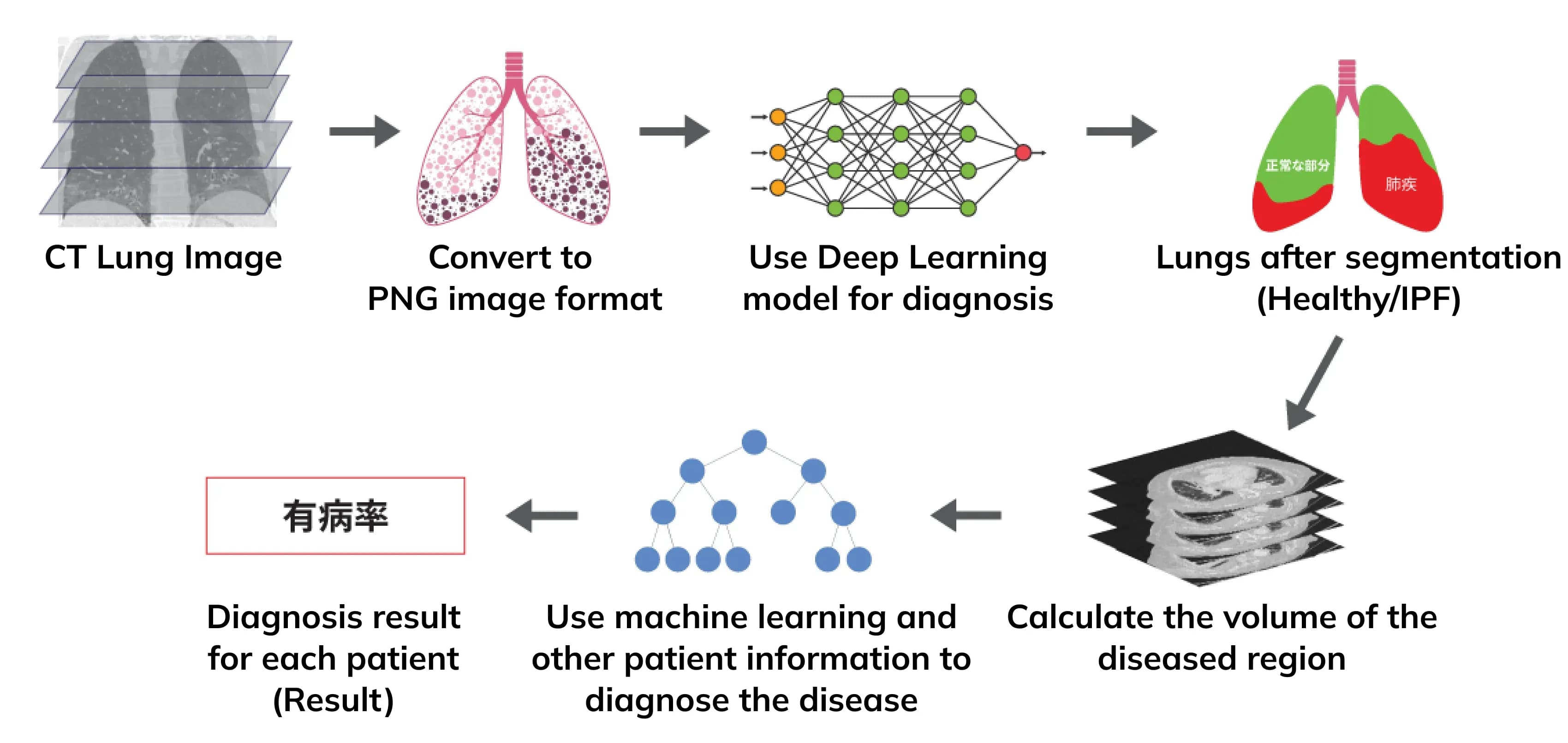 Smart AI for diagnosing Idiopathic Pulmonary Fibrosis